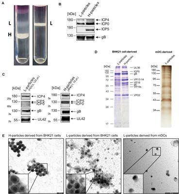 Frontiers | Mass Spectrometric Characterization of HSV-1 L